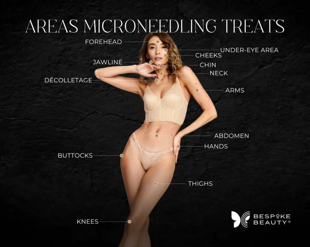 Graphic pointing to areas of woman's body
