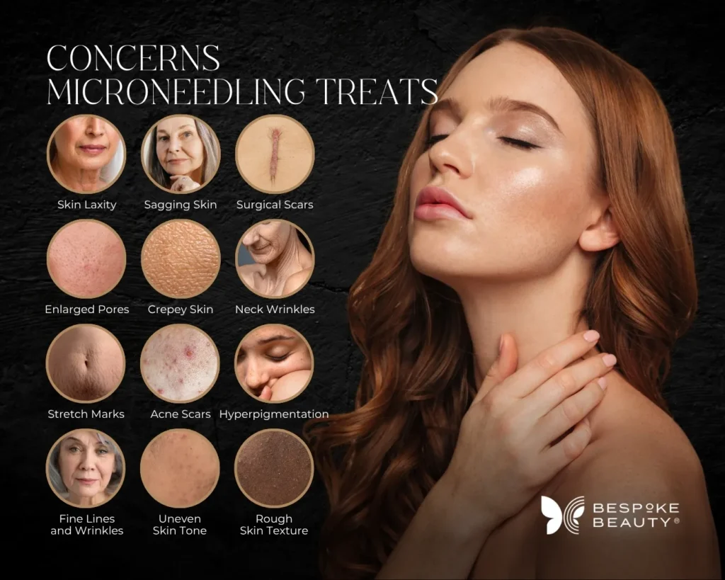 Graphic listing concerns Microneedling treats